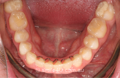orthodontics-a5